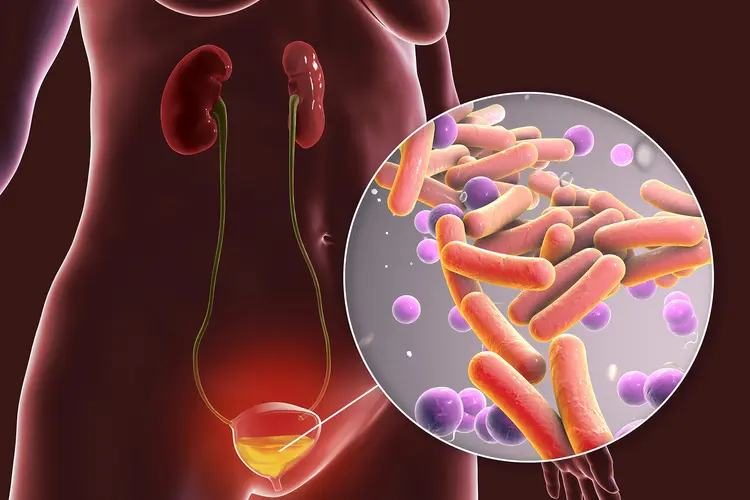 UTI in Elderly